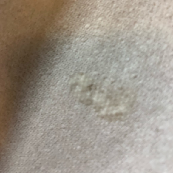 Gently moist paper towel if you run out of toilet paper you can use it! Welcome - Picture 2 of 3